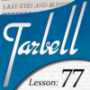 Tarbell 77: X-Ray Eyes and Blindfold Effects (Instant Download)